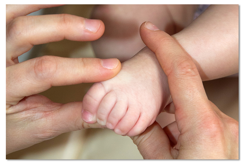 Trattamento osteopatico su piede torto podologia neonato